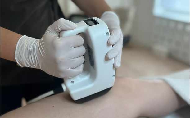 Dispositivo estético utilizado em tratamentos não invasivos de rejuvenescimento facial e corporal.