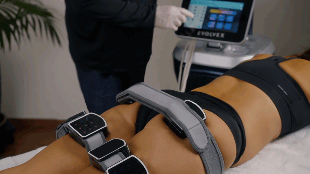 Tratamento estético EvolveX Transform para eliminar a celulite