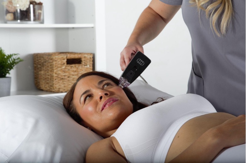 Elimina as olheiras com Morpheus8