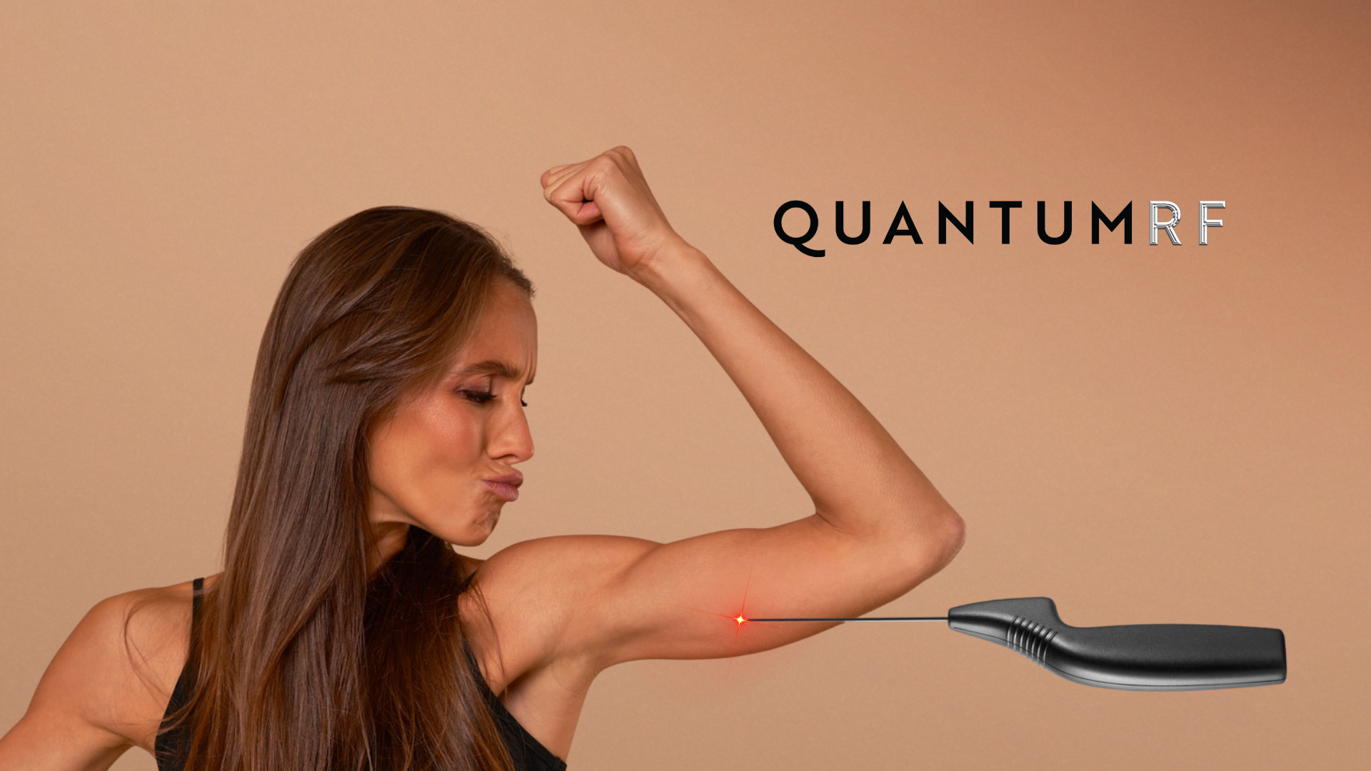 QuantumRF: Tecnologia de última geração para braquioplastia minimamente invasiva