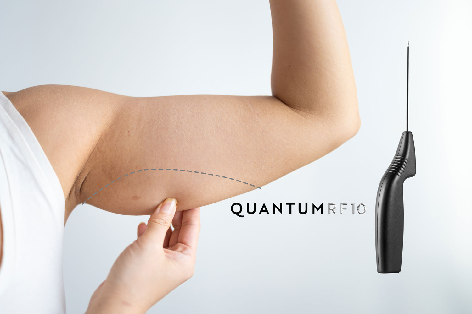 Levantamento de braços ou tratamentos não cirúrgicos?