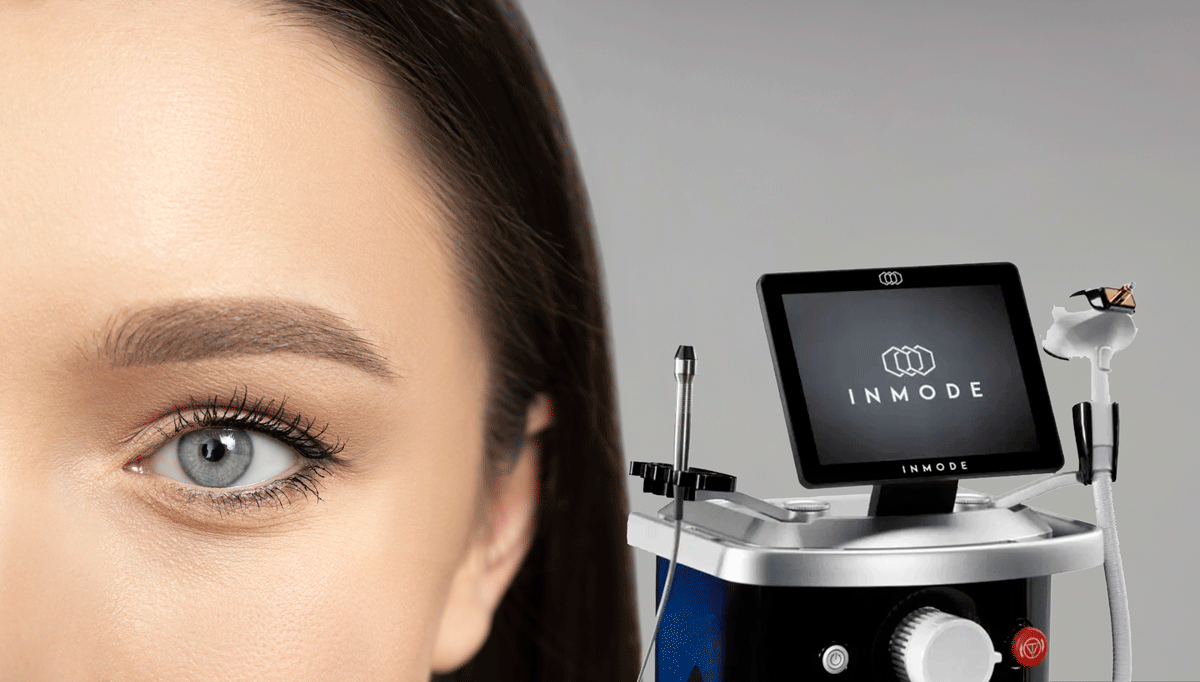 Integração de IPL e Radiofrequência Bipolar para Rejuvenescimento Periorbitário Não Invasivo