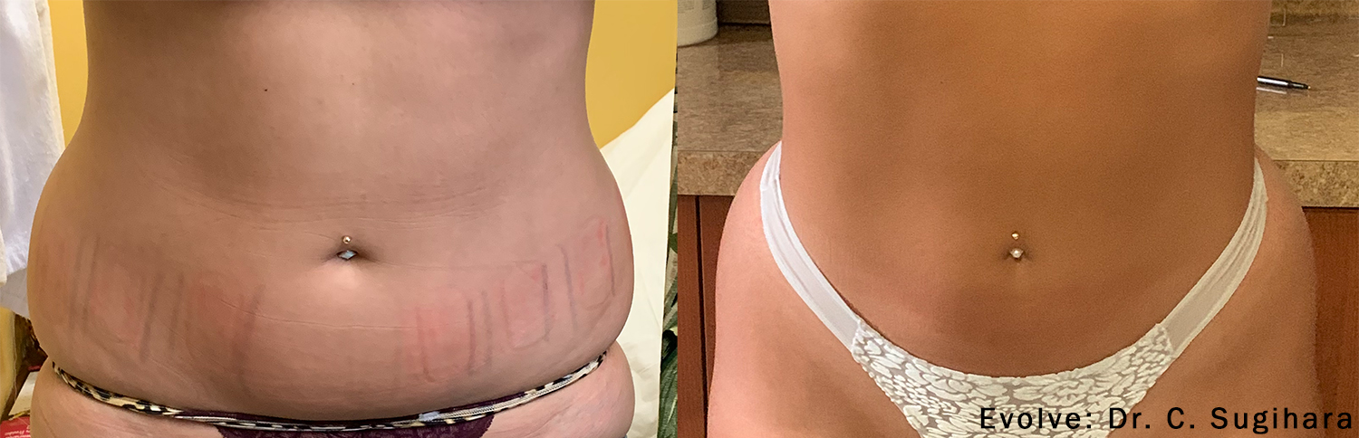 Tratamentos estéticos não invasivos para tonificação e rejuvenescimento corporal.
